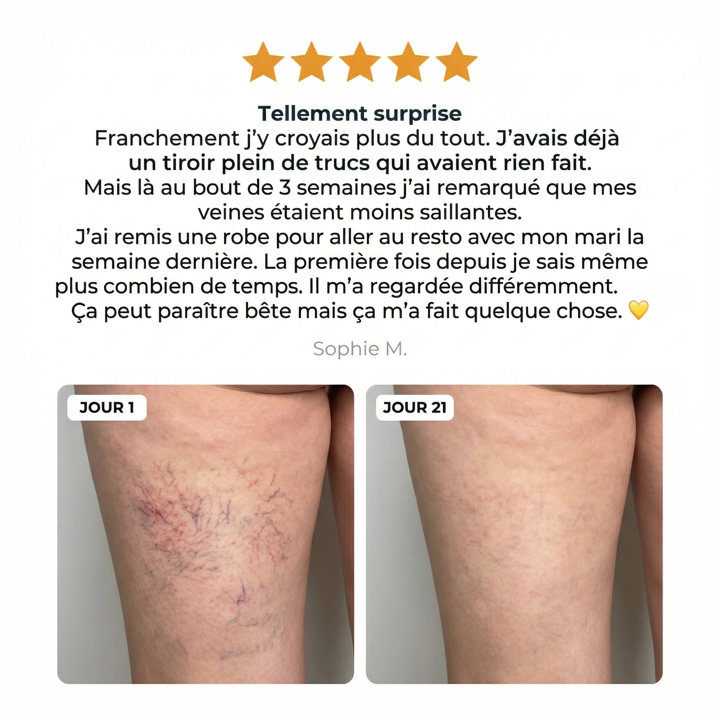 Baume Douleur